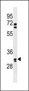 Olfactory Receptor Family 6 Subfamily B Member 2 antibody, PA5-72126, Invitrogen Antibodies, Western Blot image 