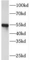 Peptidase Inhibitor 16 antibody, FNab06415, FineTest, Western Blot image 