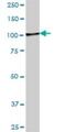 Zinc Finger CCCH-Type Containing 11A antibody, H00009877-B01P, Novus Biologicals, Western Blot image 