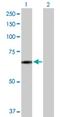 Synuclein Alpha Interacting Protein antibody, H00009627-D01P, Novus Biologicals, Western Blot image 