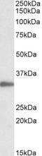 Protein Arginine Methyltransferase 7 antibody, 43-056, ProSci, Enzyme Linked Immunosorbent Assay image 