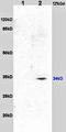 Methylenetetrahydrofolate Reductase antibody, orb11084, Biorbyt, Western Blot image 