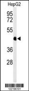 Hemojuvelin BMP Co-Receptor antibody, 64-069, ProSci, Western Blot image 