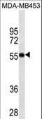 Vitamin D Receptor antibody, LS-C157347, Lifespan Biosciences, Western Blot image 