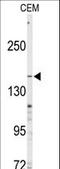 ATP Binding Cassette Subfamily C Member 4 antibody, LS-C100637, Lifespan Biosciences, Western Blot image 