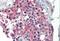 Aldehyde Dehydrogenase 1 Family Member A1 antibody, NB100-2563, Novus Biologicals, Immunohistochemistry paraffin image 