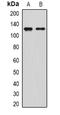Sirtuin 1 antibody, orb382038, Biorbyt, Western Blot image 