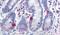 Sodium Voltage-Gated Channel Alpha Subunit 9 antibody, PA5-34191, Invitrogen Antibodies, Immunohistochemistry frozen image 