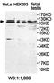 Ubiquitin Specific Peptidase 29 antibody, orb78281, Biorbyt, Western Blot image 