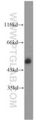 CD2 Molecule antibody, 10299-1-AP, Proteintech Group, Western Blot image 