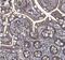 Solute Carrier Family 46 Member 3 antibody, NBP1-85054, Novus Biologicals, Immunohistochemistry paraffin image 