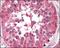 B-Raf Proto-Oncogene, Serine/Threonine Kinase antibody, NBP1-47555, Novus Biologicals, Immunohistochemistry paraffin image 