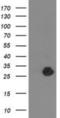 Zinc Finger AN1-Type Containing 2B antibody, NBP2-03636, Novus Biologicals, Western Blot image 