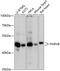 Parvin Beta antibody, 14-827, ProSci, Western Blot image 