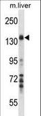 Mitogen-Activated Protein Kinase Kinase Kinase 1 antibody, LS-C164449, Lifespan Biosciences, Western Blot image 