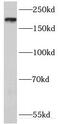 IQ Motif Containing GTPase Activating Protein 1 antibody, FNab04378, FineTest, Western Blot image 