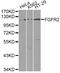 Fibroblast Growth Factor Receptor 2 antibody, A2074, ABclonal Technology, Western Blot image 