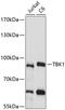 TANK Binding Kinase 1 antibody, 15-646, ProSci, Western Blot image 