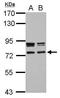 Coiled-Coil Domain Containing 151 antibody, GTX122743, GeneTex, Western Blot image 