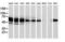 Catalase antibody, NBP2-00492, Novus Biologicals, Western Blot image 