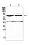 Thyrotropin receptor antibody, A00576-1, Boster Biological Technology, Western Blot image 