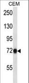 Cyclin And CBS Domain Divalent Metal Cation Transport Mediator 4 antibody, LS-C168884, Lifespan Biosciences, Western Blot image 