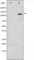 RB Transcriptional Corepressor 1 antibody, abx011462, Abbexa, Western Blot image 