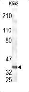 Annexin A1 antibody, 252066, Abbiotec, Western Blot image 