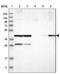 COP9 Signalosome Subunit 3 antibody, NBP1-85435, Novus Biologicals, Western Blot image 