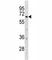 Dual Specificity Tyrosine Phosphorylation Regulated Kinase 1B antibody, F45017-0.4ML, NSJ Bioreagents, Western Blot image 