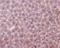 BCL2 Antagonist/Killer 1 antibody, M01163, Boster Biological Technology, Immunohistochemistry frozen image 