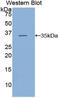 Heat Shock Transcription Factor 1 antibody, LS-C294432, Lifespan Biosciences, Western Blot image 