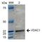 Voltage Dependent Anion Channel 1 antibody, LS-C773588, Lifespan Biosciences, Western Blot image 