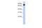 EMAP Like 3 antibody, GTX45249, GeneTex, Western Blot image 