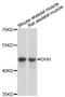 Desert Hedgehog Signaling Molecule antibody, LS-C748238, Lifespan Biosciences, Western Blot image 