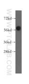 Myotubularin Related Protein 8 antibody, 12299-1-AP, Proteintech Group, Western Blot image 