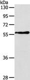Olfactomedin 4 antibody, PA5-50778, Invitrogen Antibodies, Western Blot image 