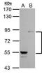 Phosphoinositide-3-Kinase Regulatory Subunit 1 antibody, GTX112995, GeneTex, Western Blot image 