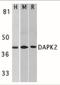 Death Associated Protein Kinase 2 antibody, NBP1-77291, Novus Biologicals, Western Blot image 