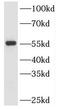 Serine Palmitoyltransferase Long Chain Base Subunit 2 antibody, FNab08207, FineTest, Western Blot image 