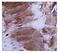 Dysferlin antibody, A01234-3, Boster Biological Technology, Immunohistochemistry paraffin image 