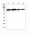 Dopamine Beta-Hydroxylase antibody, A01110, Boster Biological Technology, Western Blot image 