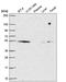 COP9 Signalosome Subunit 2 antibody, HPA061071, Atlas Antibodies, Western Blot image 