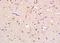 Apurinic/Apyrimidinic Endodeoxyribonuclease 2 antibody, orb101512, Biorbyt, Immunohistochemistry paraffin image 