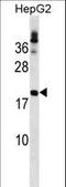 Lipoma HMGIC fusion partner antibody, LS-C160045, Lifespan Biosciences, Western Blot image 