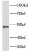 Transmembrane And Coiled-Coil Domains 6 antibody, FNab08737, FineTest, Western Blot image 