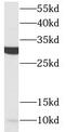 Acrosomal Vesicle Protein 1 antibody, FNab00104, FineTest, Western Blot image 