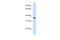 Dimethylarginine Dimethylaminohydrolase 1 antibody, 26-938, ProSci, Enzyme Linked Immunosorbent Assay image 