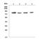 Growth Hormone Receptor antibody, A00698, Boster Biological Technology, Western Blot image 