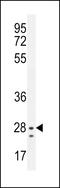 Nipsnap Homolog 3B antibody, LS-C164880, Lifespan Biosciences, Western Blot image 